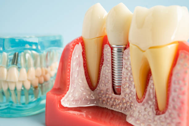 Reliable Starkville, MS  Dental Services Solutions